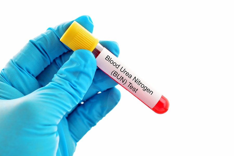 blood urea nitrogen test