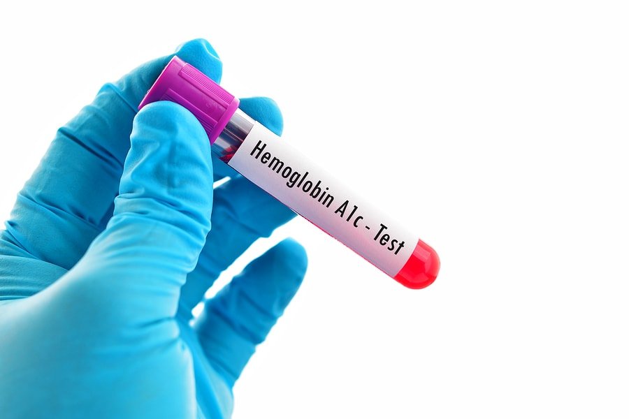 Hemoglobin blood test