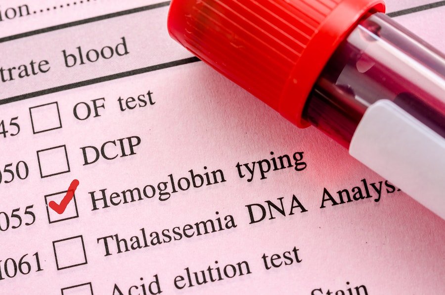 Hemoglobin test