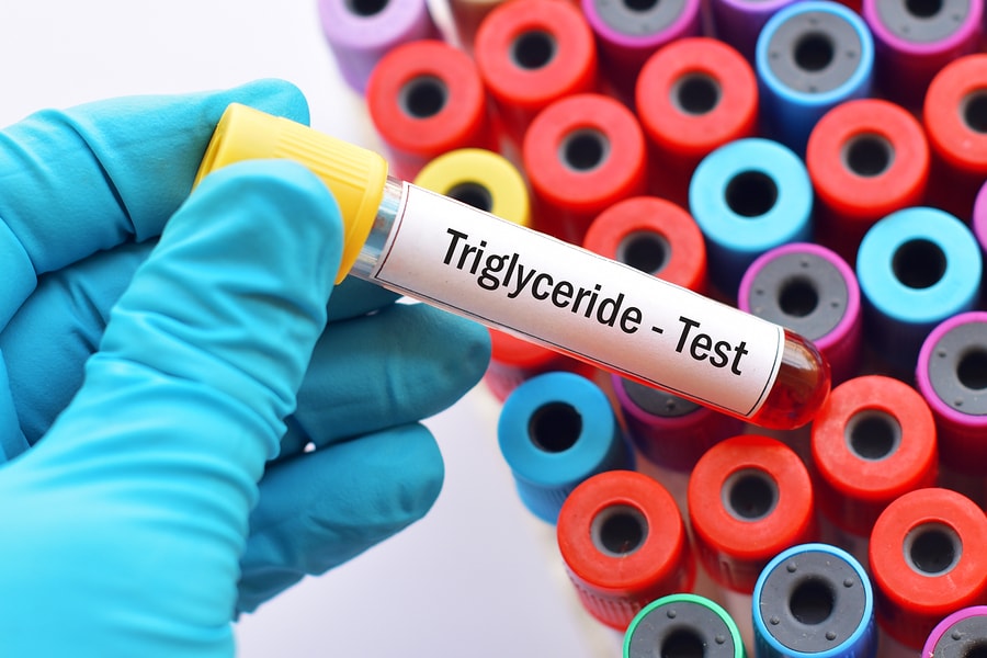 Triglycerides Test Low Levels