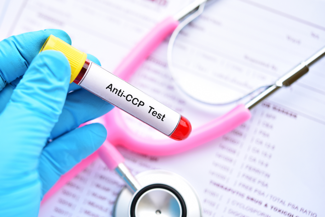 Anti-CCP antibody Test